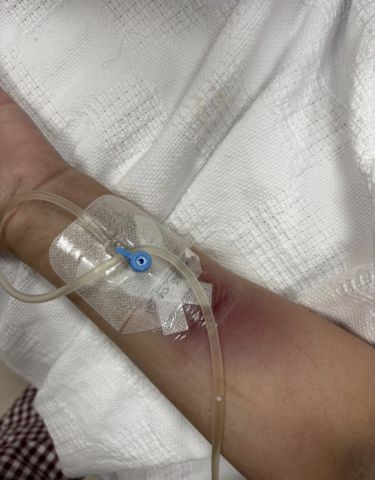 إبرة المغذي التي فصلت المدير